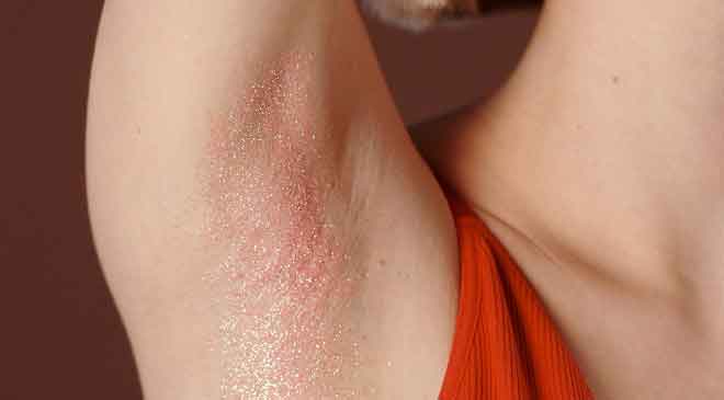 how to get rid of Underarms Armpit